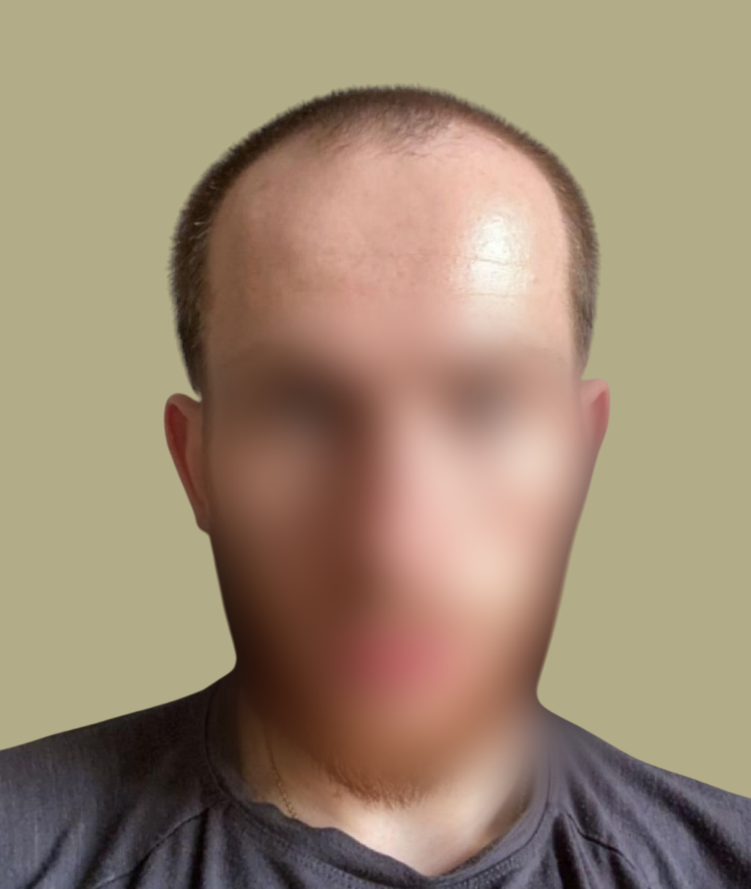 Antes-e-depois-2-Photoroom