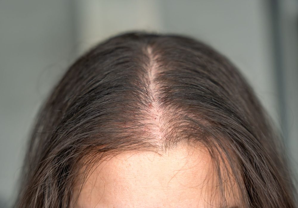 CAPILAR FEMININO